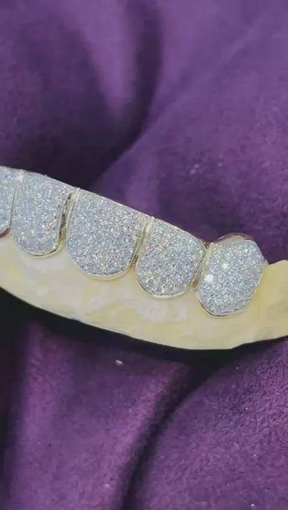 Custom Grillz